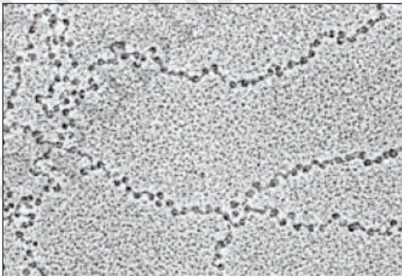 Figure 5.4b EM picture - Beads-on-String'